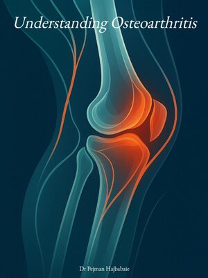 cover image of Understanding Osteoarthritis ()